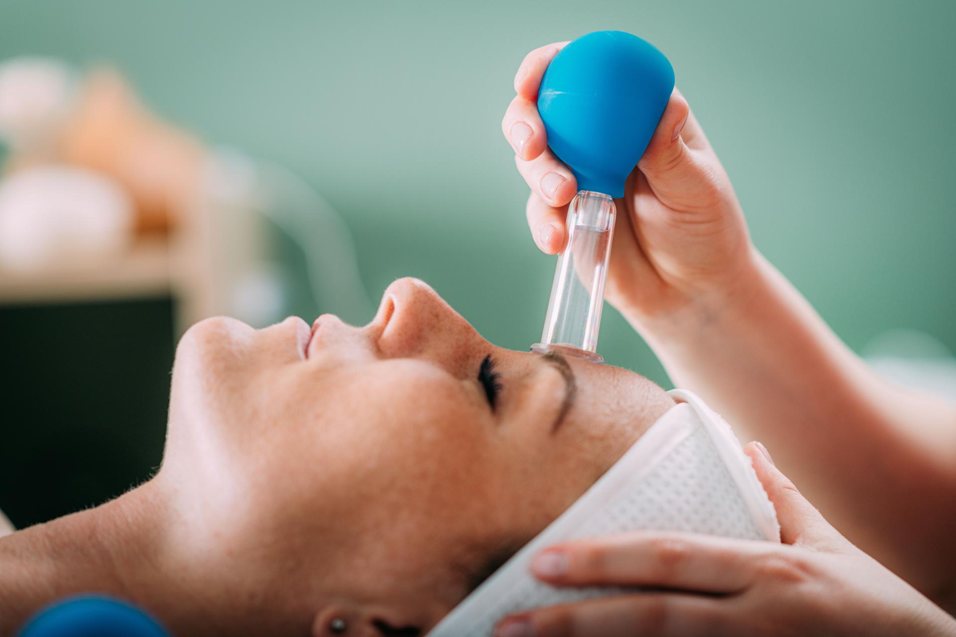 Cupping therapy, ventosa cupping face treatment in a beauty salon